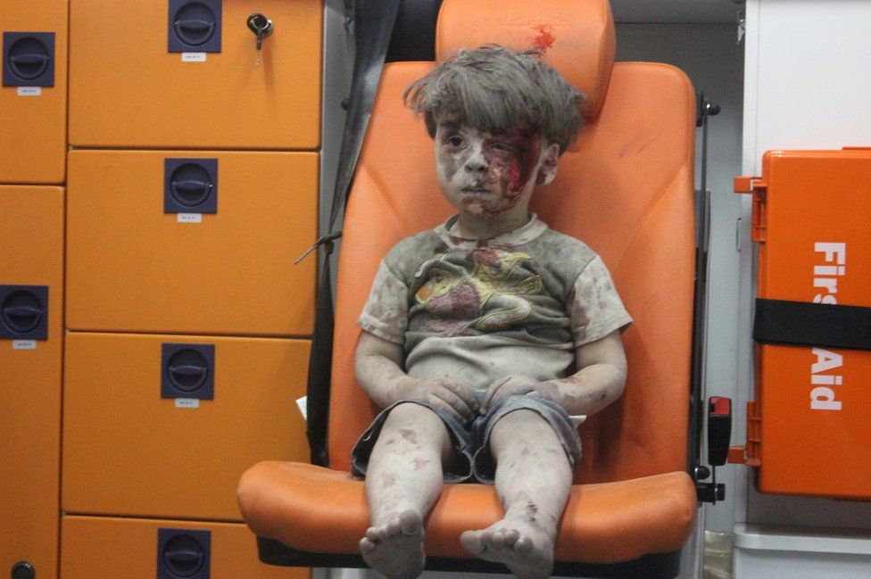Halep'teki bir hava saldırısının ardından enkaz altından çıkartılan beş yaşındaki Ümran Dakneş'in bu fotoğrafı, tüm dünyada yankı uyandırdı. Kafası karışmış bir şekilde ne olduğuna anlam veremeden ambulansta hareketsizce oturan Ümran'ın fotoğrafı, sosyal medyada yaygın bir şekilde paylaşıldı.