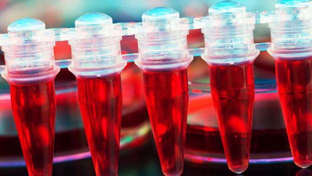 Hastalıkların tespiti için geliştirilen ve biyobelirteçleri (biomarker) deri üzerinden algılayabilen biyonsensör teknolojisi ile düşük hacimde vücut sıvısı kullanılarak çoklu hastalık tespiti hızlanarak kolaylaşıyor. 2010 yılında çalışmalarına başlanan projede benzer sistemler kullanılarak tümörler tespit edilebilecek.